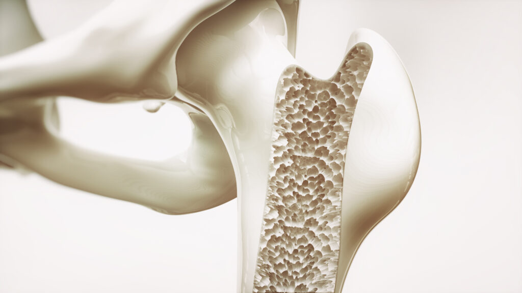 Bone Health